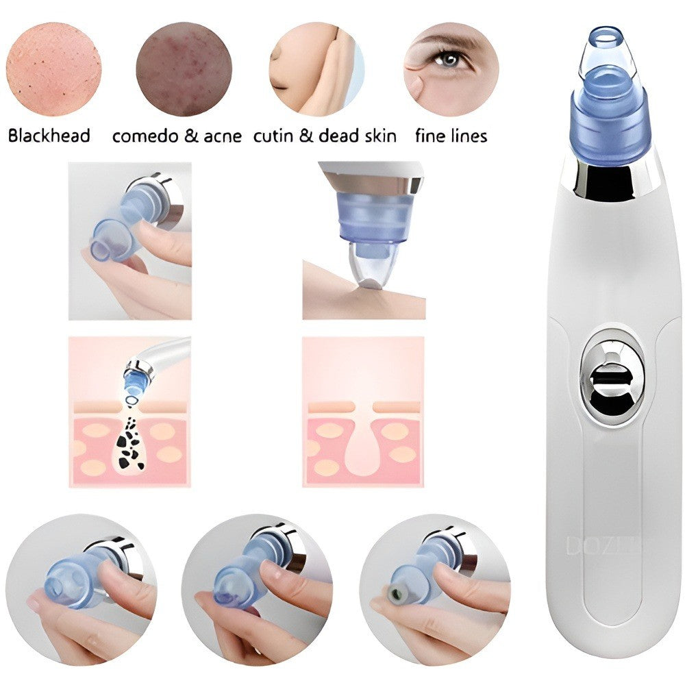 Derma Suction Blackheads Remover LivSmart