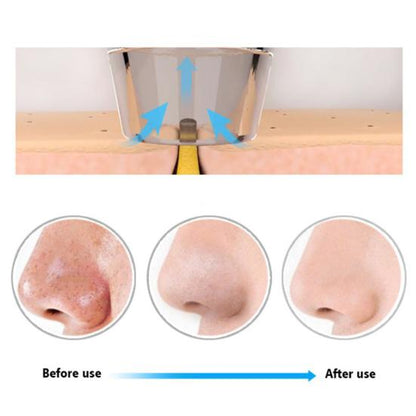 Derma Suction Blackheads Remover LivSmart