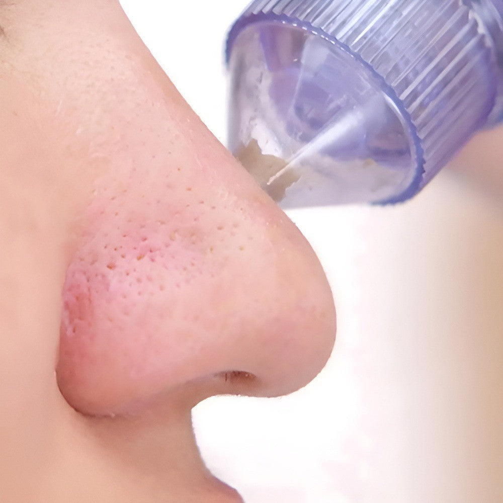 Derma Suction Blackheads Remover LivSmart