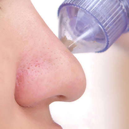 Derma Suction Blackheads Remover LivSmart