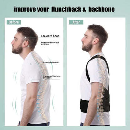 Back Pain Relief Belt | Instant Posture Corrector
